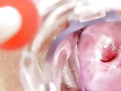 La enfermera cochina se queda iray solas